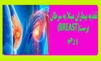 تغذیه بیماران مبتلا به سرطان برست(Breast) و رحم 